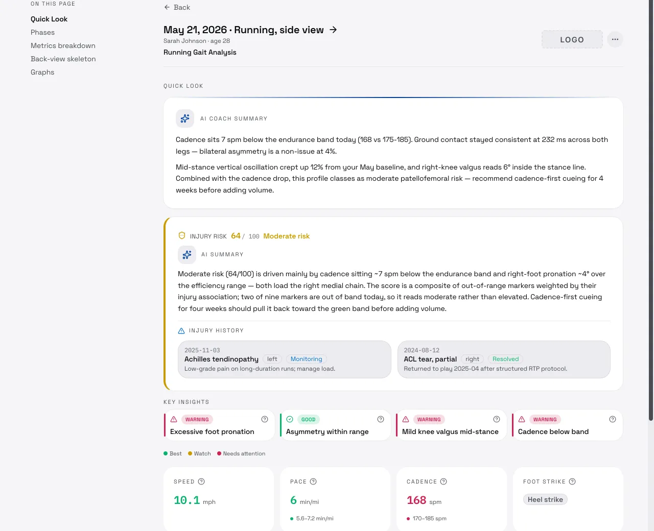 AiKYNETIX running gait session report — AI summary, injury-risk score, key insights, and biomechanics metrics.